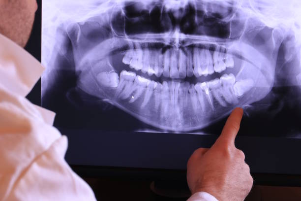 Best Emergency Treatment for Oral Infections in Torrance, CA